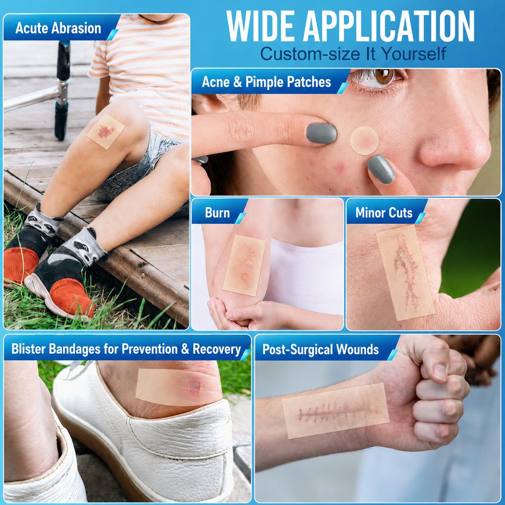 Hydrocolloid Acne Patch Roll 5 - Hydrocolloid Pimple Patch ulasan dan harga